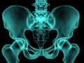 X-ray human bones Ã¢ââ3
